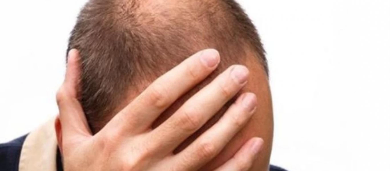 Φαλάκρα και γκριζάρισμα: Πώς συνδέονται με τον αυξημένο κίνδυνο καρδιάς